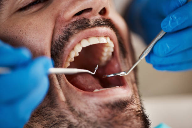 Best Broken or Cracked Tooth Emergency Dentist in Niagara Falls, NY