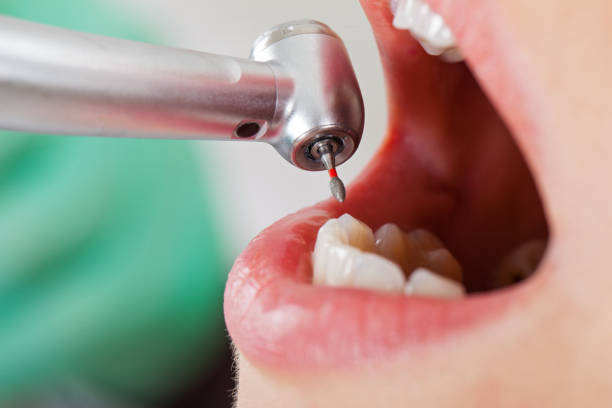 Best Emergency Dentist for Knocked-Out Tooth in Niagara Falls, NY